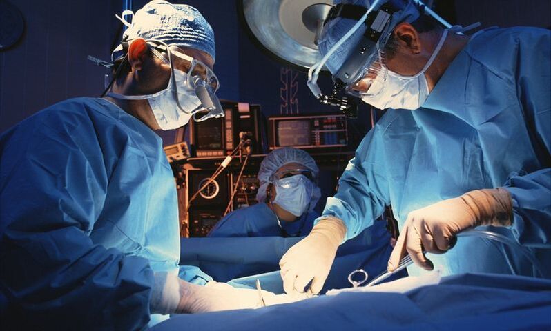 pénisznövelő műtét